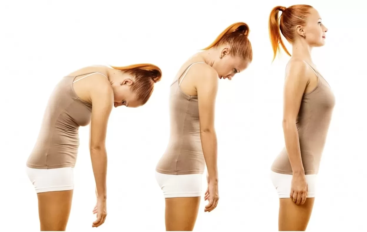 Scoliosis Patients and Corset Use