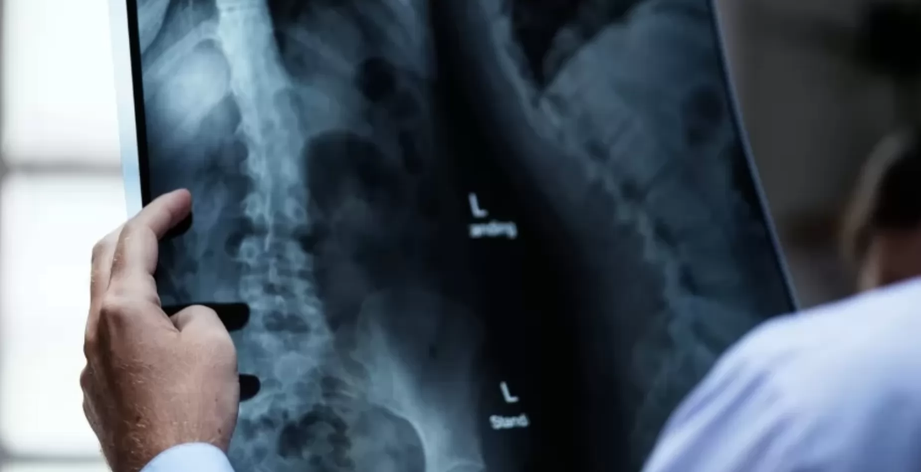 How Long Does Scoliosis Surgery Take?