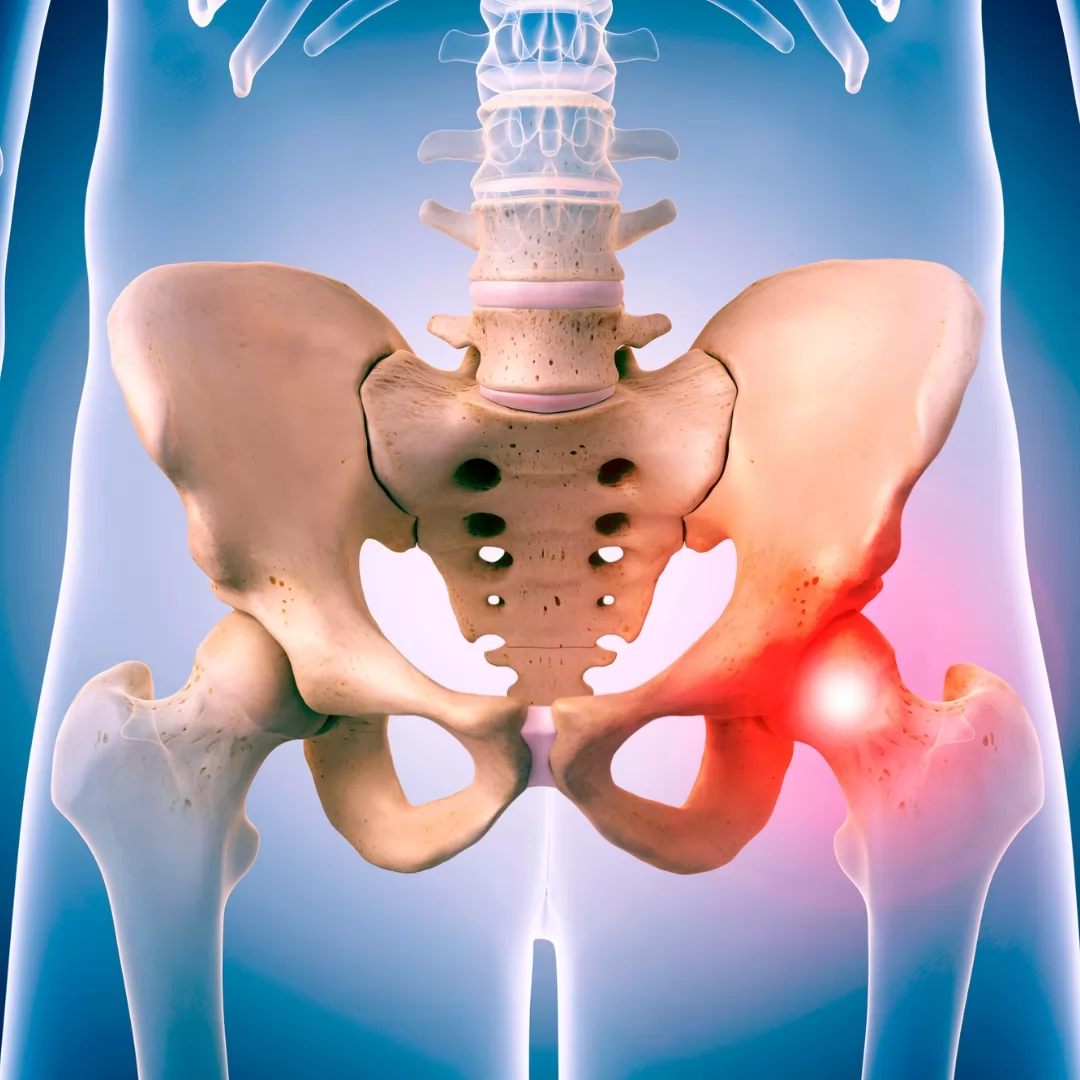 Hip Joint Diseases