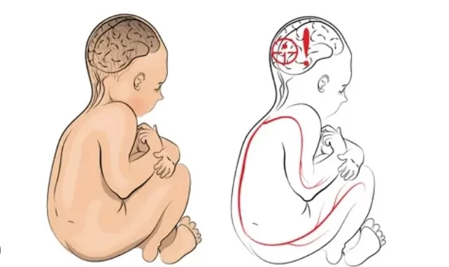 Serebral Palsi'li bir çocuğun gücünü asla küçümsemeyin